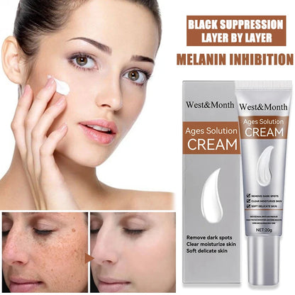 Remove Freckle Cream Whitening Dark Spots Effective Remove Melasma Serum Melanin Moisturize Brighten Smooth Face Skin Care