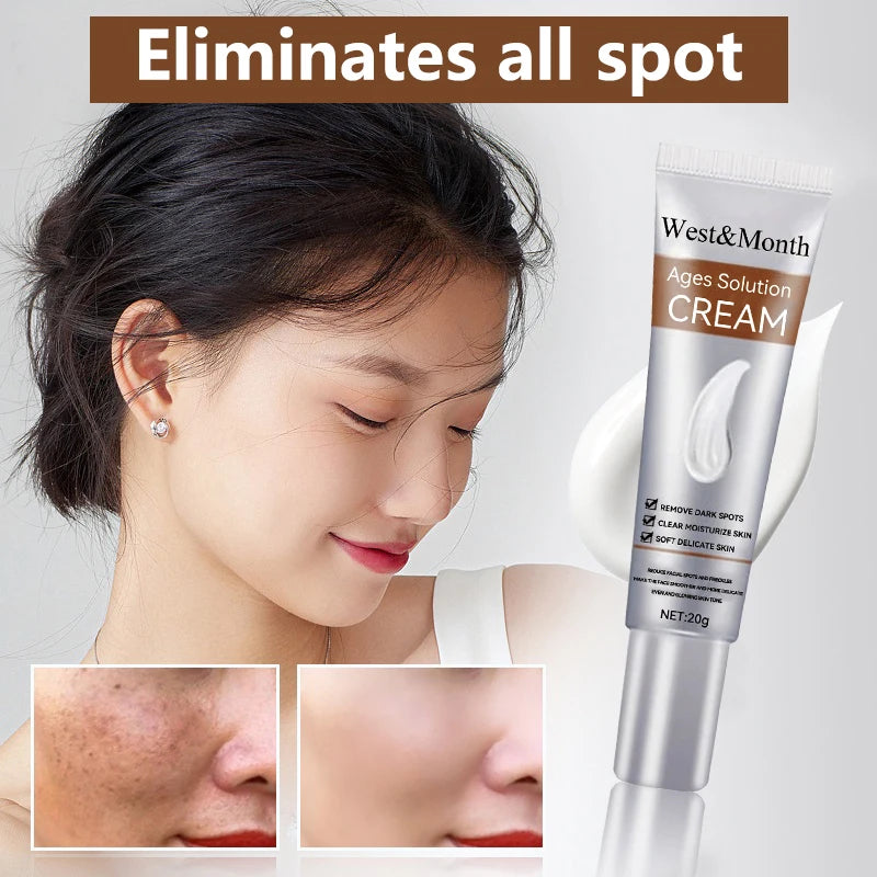 Remove Freckle Cream Whitening Dark Spots Effective Remove Melasma Serum Melanin Moisturize Brighten Smooth Face Skin Care