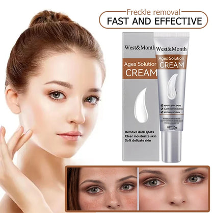 Remove Freckle Cream Whitening Dark Spots Effective Remove Melasma Serum Melanin Moisturize Brighten Smooth Face Skin Care