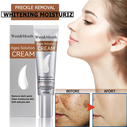 Remove Freckle Cream Whitening Dark Spots Effective Remove Melasma Serum Melanin Moisturize Brighten Smooth Face Skin Care