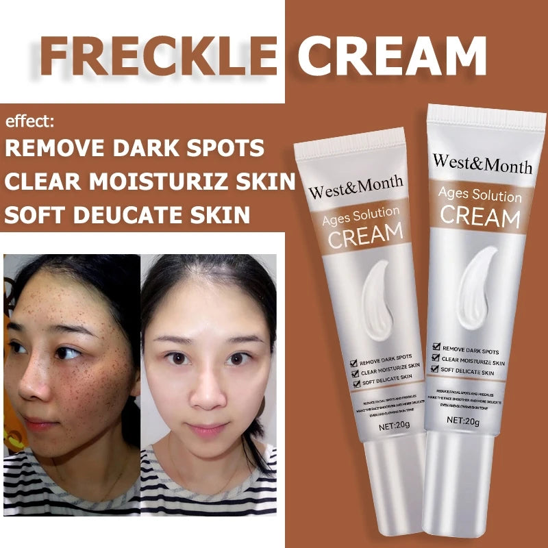 Remove Freckle Cream Whitening Dark Spots Effective Remove Melasma Serum Melanin Moisturize Brighten Smooth Face Skin Care